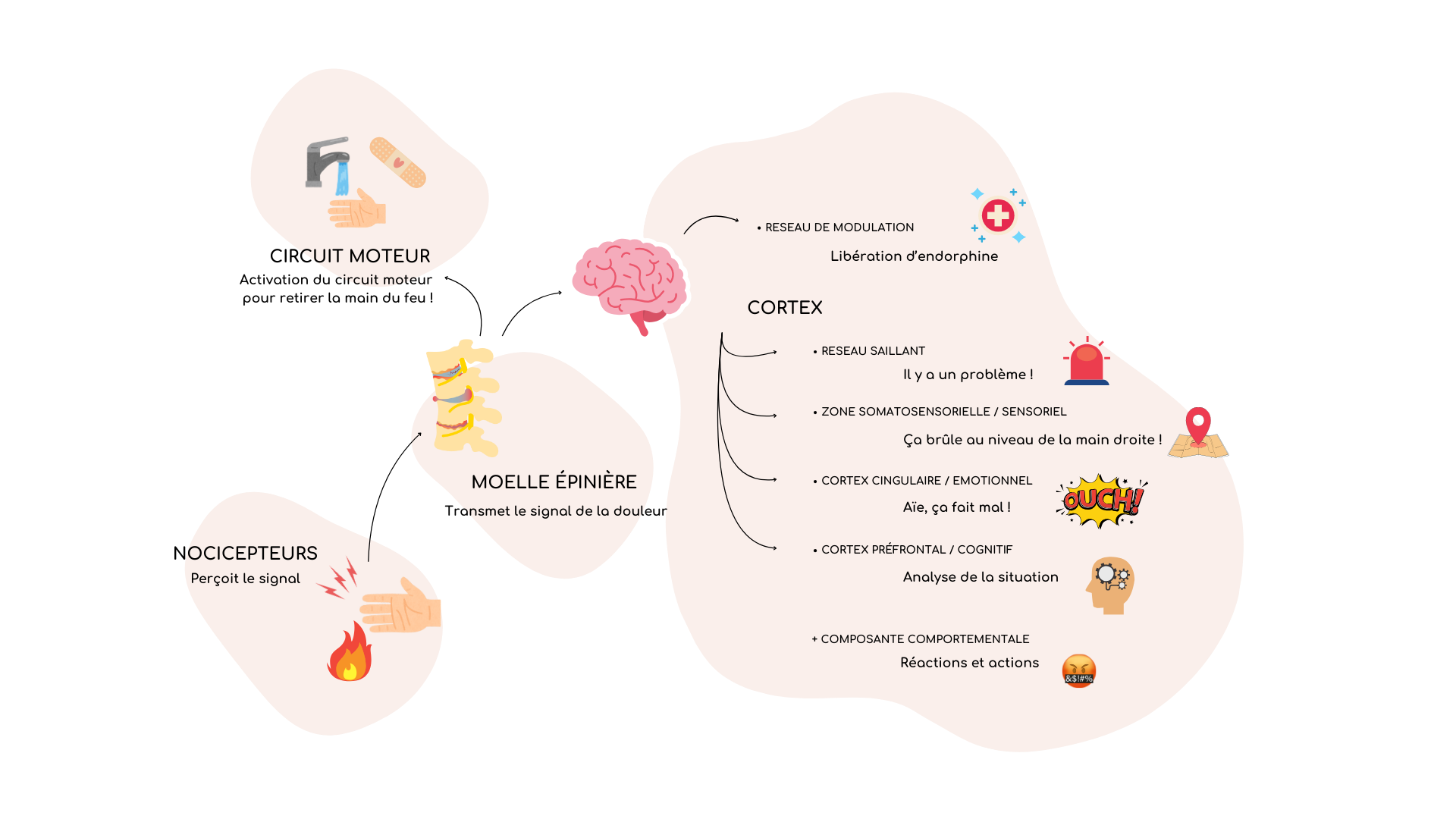 Schéma du traitement de la douleur. Apaiser la douleur. Hypnose. Hypnose ericksonienne.